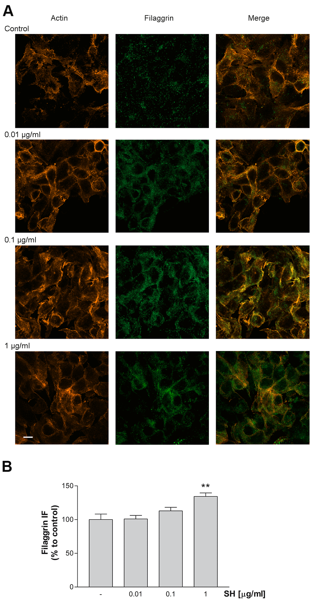 Effect of Salvia haenkei extract 0.01- 0.1 and 1 μg/ml on filaggrin and actin proteins expression in HaCaT cells. (A) Images were collected by confocal laser-scanning microscope LSM800 and software ZEN 2.1, magnification 60X, and are representative of at least 3 experiments. Scale bar = 10μm. (B) Quantitative analysis of filaggrin fluorescence intensity (related to area). Results are the mean ± SEM of 3-5 experiments. **pvs control.