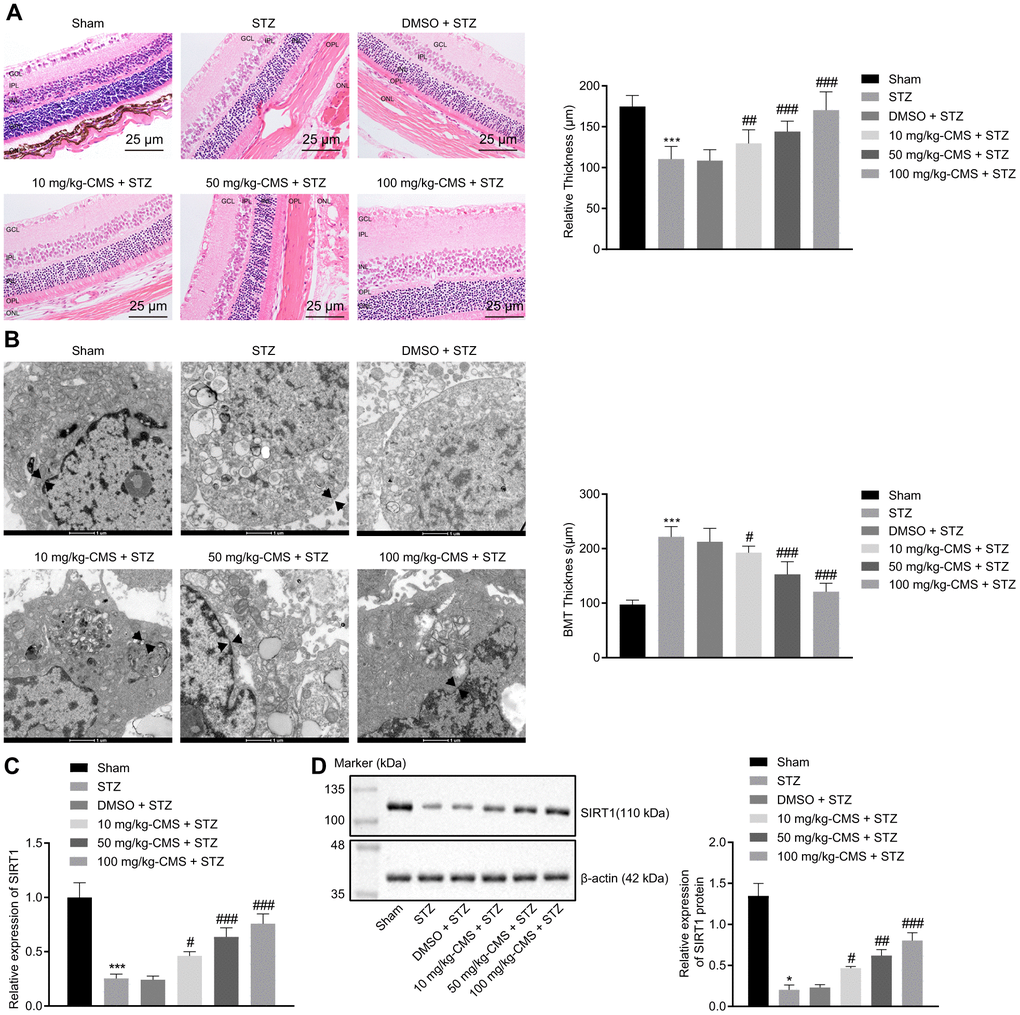 SIRT1 was down-regulated in the STZ-induced DR rat model. STZ-treated rats were further treated with DMSO, 10 mg/kg CMS, 50 mg/kg CMS, and 100 mg/kg CMS. n = 15 per treatment. (A) Representative images of retinal tissues observed by HE-staining (× 400) (scale bar = 25 μm) and quantitative analysis of thickness. * p #p B) Ultrastructure of rat retinal tissues observed under a TEM (× 10000) (scale bar = 1 μm). The arrow represents the capillary BMT, which is used to measure basement membrane width. (C) Expression pattern of SIRT1 measured by RT-qPCR in rat retinal tissues, normalized to β-actin. (D) Representative Western blots of SIRT1 protein and its quantitation in rat retinal tissues, normalized to β-actin. *p **p ***p #p ##p ###p 