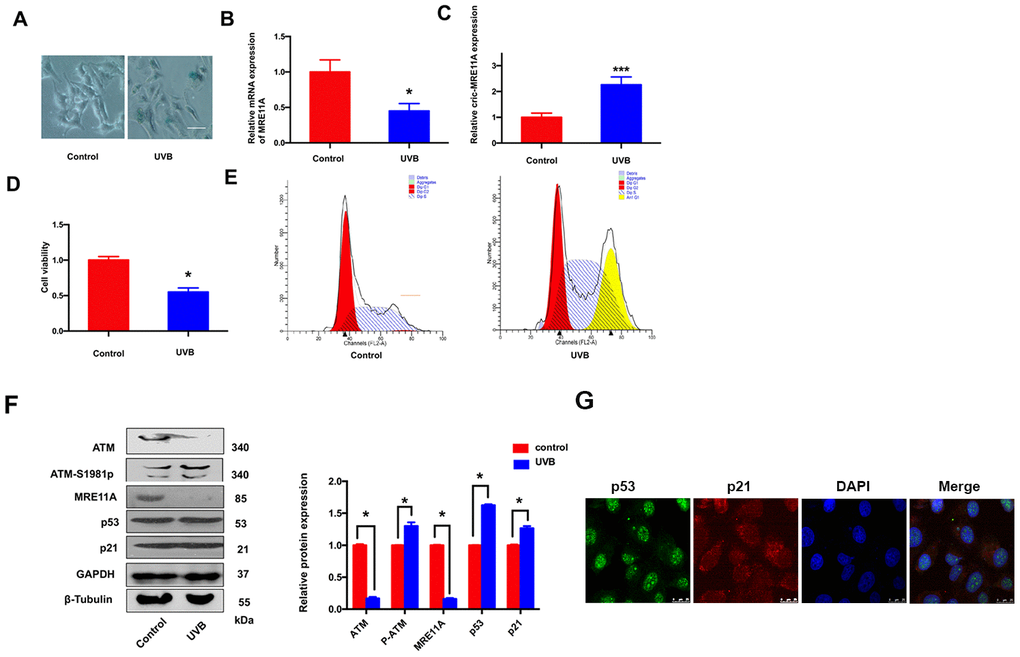 LECs senescence was raising under UVB-inducing oxidative damage in vitro. (A). The number of SA-β-gal-positive SRA01/04 cells exposed under UVB were increased than controls. Scale bar: 25μm. (B). When UVB induced cells aging, the expression level of MRE11A mRNA was down-regulation. *pC). The expression level of circMRE11A was up-regulation compared with controls. ***pD). CCK-8 showed that the cell viability in UVB group was decreased. *pE). Flow cytometry demonstrated that cell cycle was inhibited in G1/S in UVB group. (F). Western Blot showed that the expression of ATM or MRE11A proteins were decreased, while the expression level of ATM-S1981p was increasing in UVB group compared with controls. Meanwhile, the relative increase of p53 and p21 was in UVB group compared with controls. (G) Immunofluorescence showed that p53 and p21 were co-located in the nucleus of cells. *p