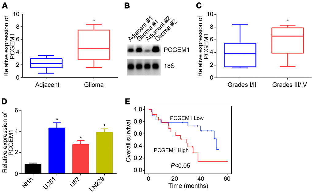 PCGEM1 expression in glioma. (A) PCGEM1 expression in glioma tissues and adjacent normal tissues. (B) Northern blot was performed to analyze PCGEM1 expression in glioma tissues. (C) Relative expression of PCGEM1 in glioma tissues with different grades. (D) PCGEM1 expression in glioma cell lines was analyzed. (E) Survival rate was examined based on PCGEM1 expression. *P