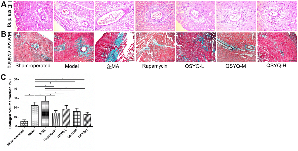 Effect of QiShen YiQi pill (QSYQ) on myocardial histology in rats. (A) Representative photomicrograph of hematoxylin and eosin (H&E) staining of the myocardium (×200). (B) Representative photomicrograph of mason trichrome staining of the myocardium (×200). (C) The myocardial collagen volume fraction for each group. Data are expressed as mean ± SD. *P#P