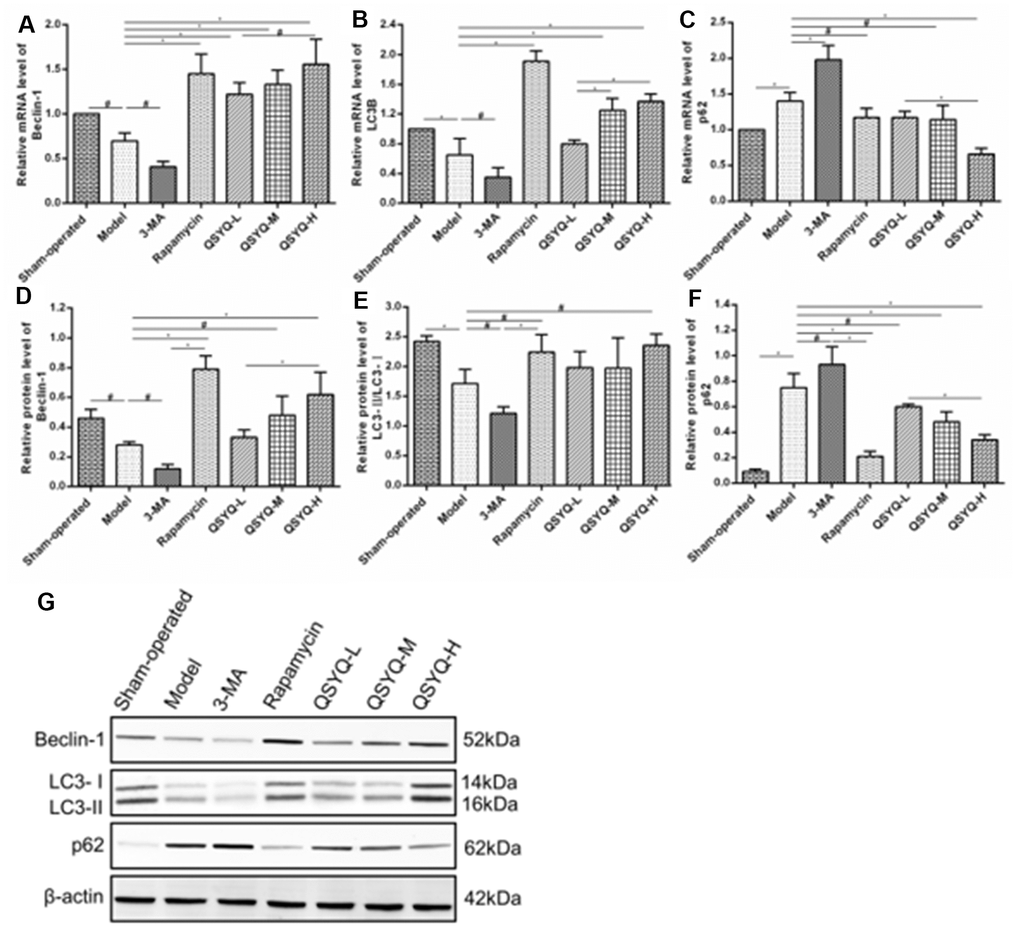 Effect of QiShen YiQi Pill (QSYQ) on expression of Beclin-1, LC3B, and p62 in rats. (A) The Beclin-1 mRNA expression for each group. (B) The LC3B mRNA expression for each group. (C) The p62 mRNA expression for each group. (D) The relative protein level of Beclin-1 in the myocardium. (E) The relative protein level of LC3-II/LC3-II in the myocardium. (F) The relative protein level of p62 in the myocardium. (G) Beclin-1, LC3-II, LC3-I, and p62 expression in the myocardium of rats in each group as detected by western blot. Data are expressed as mean ± SD, *P#P