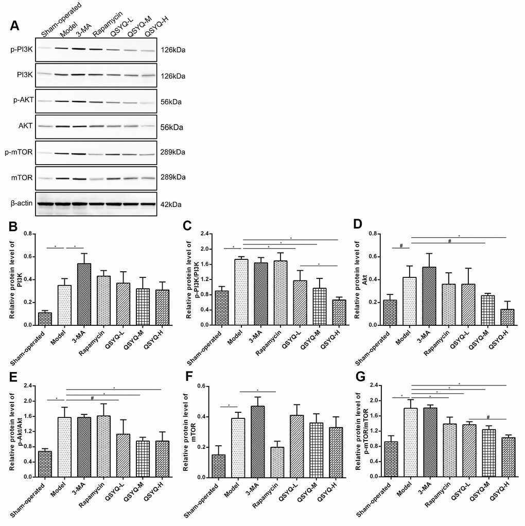 Effect of QiShen YiQi Pill (QSYQ) on the primary molecules of PI3K/AKT/mTOR pathway. (A) Western blot analysis of protein in the myocardium of rats in each group. (B) The relative protein level of PI3K in the myocardium. (C) The relative protein level of p-PI3K/PI3K in the myocardium. (D) The relative protein level of AKT in the myocardium. (E) The relative protein level of p-AKT/AKT in the myocardium. (F) The relative protein level of mTOR in the myocardium. (G) The relative protein level of p-mTOR/mTOR in the myocardium. Data are expressed as mean ± SD. *P#P