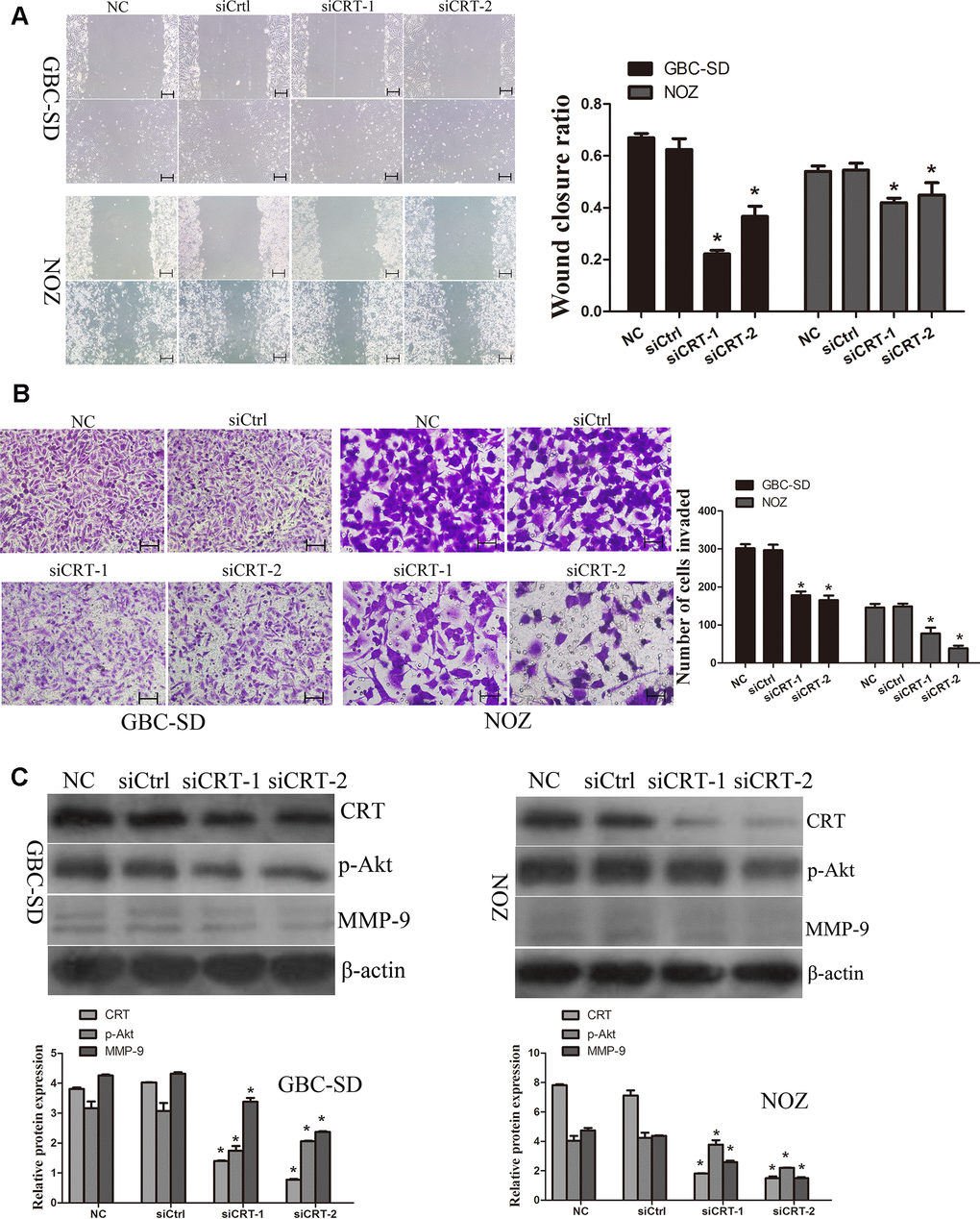 Knockdown of CRT significantly inhibits cell migration in vitro. (A) Cell migratory ability was detected by wound healing assay. (B) Cell migratory ability was detected by Transwell assay. Scale bars =200um. (C) Western blot assay revealed that knockdown of CRT inhibited the expression of p-Akt and MMP-9 in GBC-SD and NOZ cells.*P