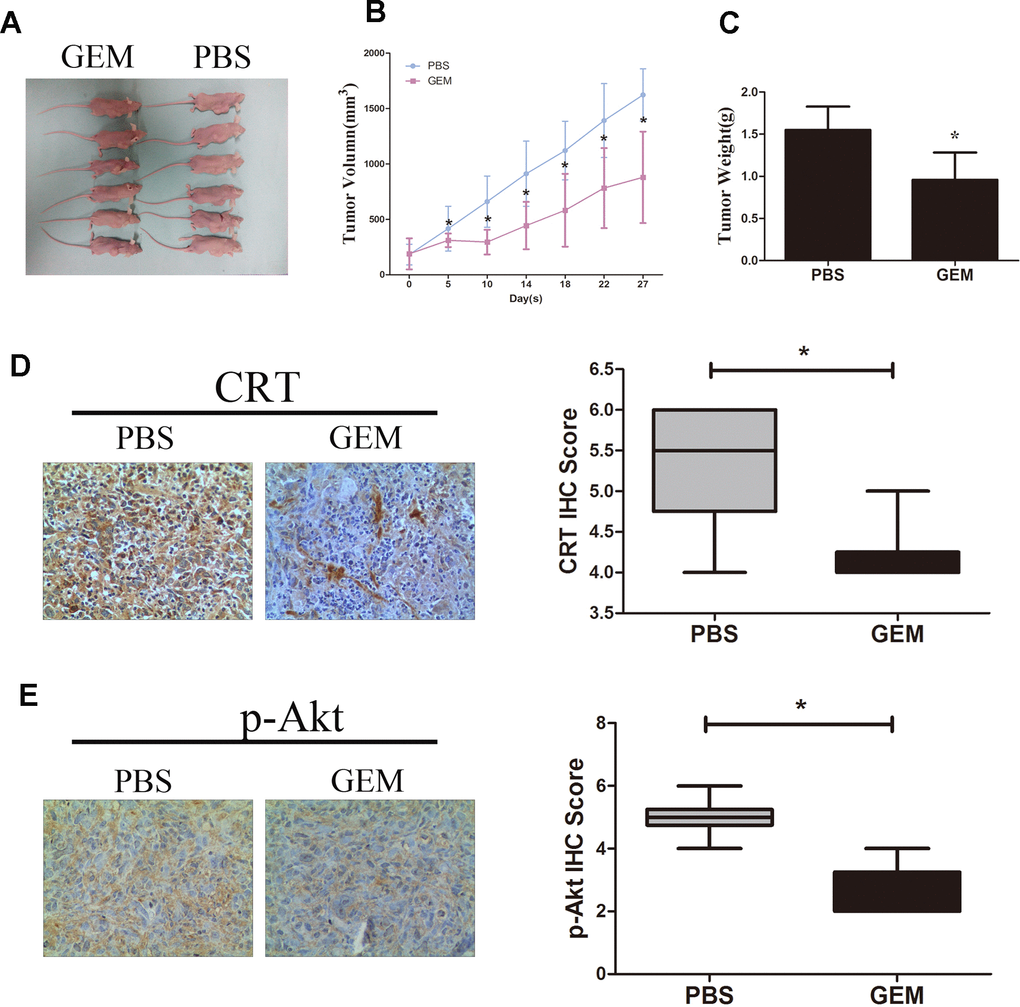 GEM inhibits tumor growth and downregulates the expression of CRT and p-Akt in GBC-SD xenografts. (A) Xenografted tumors derived by GBC-SD cells treated with PBS or GEM. (B) Growth curvesin mice are presented. (C) Tumor weights were measured at the endpoint of the animal experiments. (D, E) Expression levels of CRT and p-Akt in xenograft tumor were detected by IHC.*P