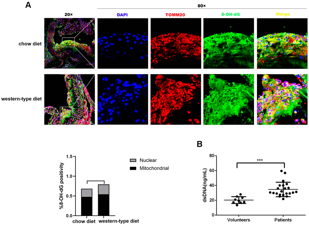 Mitochondrial DNA damage in atherogenesis. ApoE -/- mice were fed a western-type diet or a chow diet for 16 weeks. Immunofluorescence was used to analyze aortic root plaques. (A) Oxidative damage to DNA was measured by immunostaining of 8-OH-dG (green) (n = 6, Scale bars: 100μm for 20× images and 10μm for 80× images). Quantitative analysis of 8-OH-dG+ cells in selected areas showed that strong 8-OH-dG staining was discovered mainly in mitochondria (TOMM20, red) compared with nuclei (DAPI, blue) (P = 0.037 in the chow diet group, and P = 0.018 in the western-type diet group). (B) The plasma dsDNA levels of atherosclerosis patients and volunteers were analyzed using a PicoGreen ® dsDNA quantitative kit. ***P