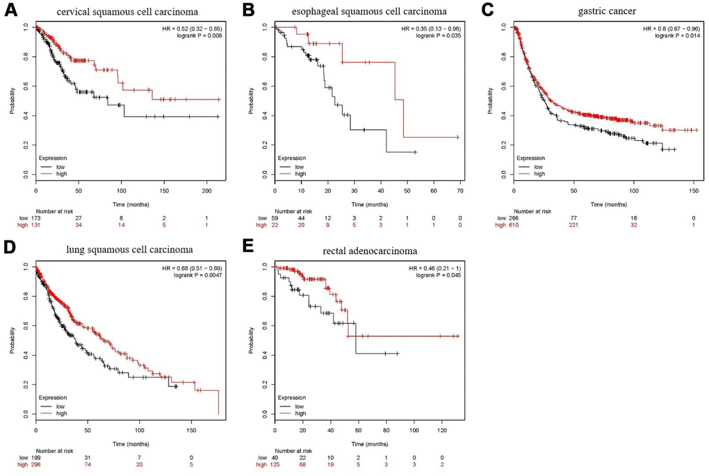 Prognostic analysis of FANCE in multiple cancers. (A) For cervical squamous cell carcinoma, high expression of FANCE is associated with good prognosis (*PB) In esophageal squamous cell carcinoma patients, up-regulated expression of FANCE is associated with good prognosis (*P=0.035); (C) For gastric cancer, increased expression of FANCE is associated with better prognosis (*P=0.014); (D) For lung squamous cell carcinoma, up-regulated expression of FANCE predicts improved prognosis (*P=4.7×10-3); (E) For rectal adenocarcinoma, increased expression of FANCE is associated with better prognosis (*P=0.045).