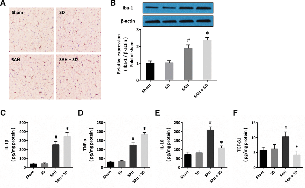 Sleep deprivation regulates neuroinflammation after SAH. (A) Cytochemistry assay shows that sleep deprivation increased the number of Iba-1 positive cells after SAH. (B) Western blot shows that sleep deprivation increased the expression of Iba-1 after SAH. (C–F) ELISA shows that sleep deprivation increased the levels of IL-1β (C) and TNF-α (D), but decreased the levels of IL-10 (E) and TGF-β1 (F) after SAH in rats. The data was represented as means ± SEM. #p *p 