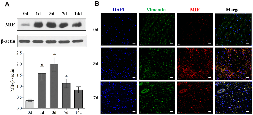 MIF expression was upregulated in the posterior joint capsule after PTJC. (A) Western blot analysis of MIF in the posterior joint capsule at day 0, 1, 3, 7, and 14 after PTJC induction. Endogenous β-actin was used as an internal control. (B) Immunostaining showed colocalization of MIF (red) with JFs in the posterior joint capsule at day 0, 3, and 7 after PTJC induction. Cell nuclei were stained with DAPI (blue). Vimentin was used as a fibroblast marker (green). Scale bars, 20 μm. Error bars represent standard deviation. *P 