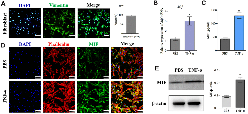 MIF expression increased in TNF-α-induced primary JF inflammation model. (A) Immunofluorescence of purified primary JFs. Vimentin was used as a marker of JFs (green). Cell nuclei were stained with DAPI (blue). Scale bar, 100 μm. (B–E) Expression of MIF in JFs in response to 20 ng/mL TNF-α treatment for 24 h was determined via qRT-PCR (B), ELISA (C), and immunofluorescence (D), and western blot (E). Phalloidin was used to stain the cytoskeleton (red); cell nuclei were stained with DAPI (blue). Scale bar, 100 μm. Error bars represent standard deviation. *P 