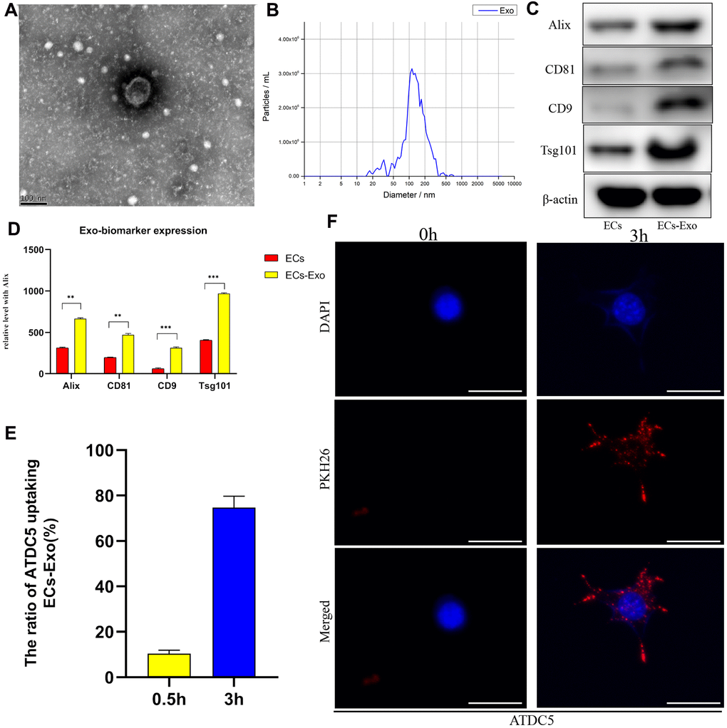 Identification and internalization of EC-Exos. Exosomes were isolated from samples with a total exosome extraction kit or ultrafiltration from mouse vascular EC medium. (A) Morphological features of EC-Exos were observed via transmission electron microscopy. (B) Particle sizes of exosomes were monitored with NTA. The X-axis shows the particle sizes in the sample, and the Y-axis shows the concentrations of particles of a certain size. Total protein was extracted from exosomes and analyzed with western blotting. (C, D) Representative images showing the expression of the exosome surface markers Alix, CD81, CD9 and Tsg101. PKH26-labeled exosomes were co-cultured with ATDC5 cells for 3 hours. (E) Quantitative analysis of the uptake rates of exosomes in ATDC5. (F) Immunofluorescence images showing the uptake of EC-Exos by ATDC5. The nuclei were labeled with DAPI (blue), and PKH26-labeled exosomes were internalized by ATDC5 cells (red). ***p