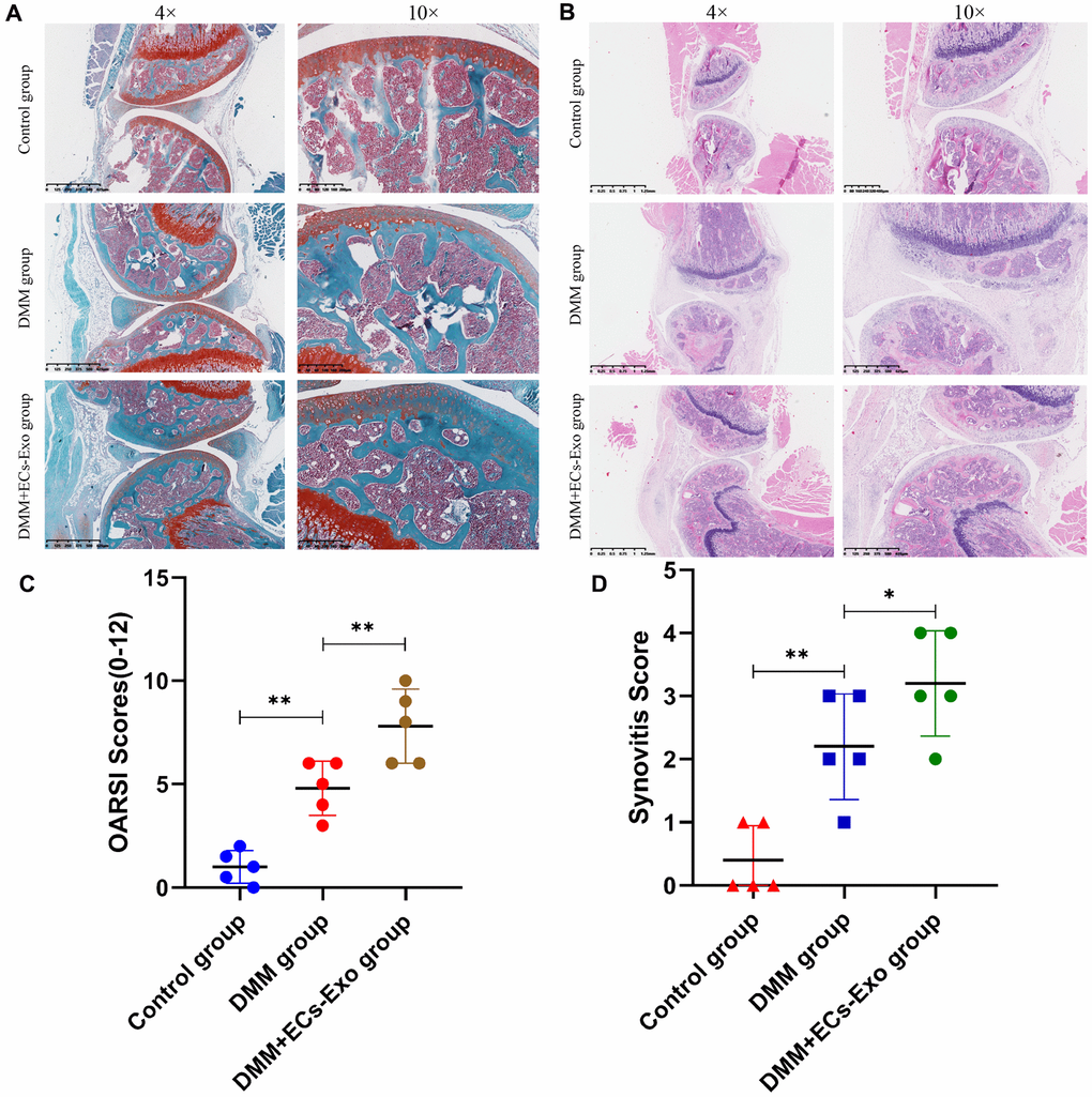 EC-Exos promoted the progression of OA in vivo. (A, B) Representative S-O staining and HE staining of knee-joint samples. (C) OARSI scores of knee joints in three groups of mice. (D) Synovitis scores of knee joints in three groups of mice. ***p