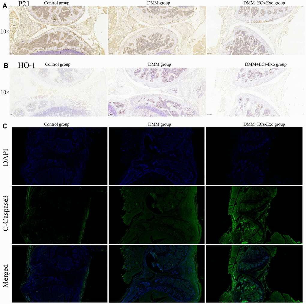 EC-Exos decreased the ability of chondrocytes to resist oxidative stress and increased the number of apoptotic chondrocytes in the OA mouse model. (A) Immunohistochemical staining for p21 expression in the knee-joint samples. (B) Immunohistochemical staining for HO-1 expression in the knee-joint samples. (C) Immunofluorescence staining for C-caspase3 expression in the knee-joint specimens from three groups of mice.
