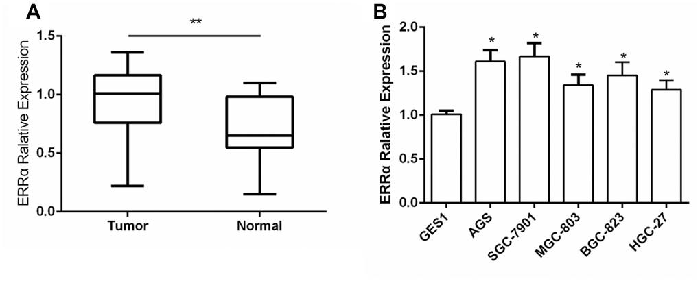 The expression of ERRα in GC tissues and GC cell lines. (A) The expression of ERRa in GC tissues; (B) The expression of ERRa in GC cell lines *P