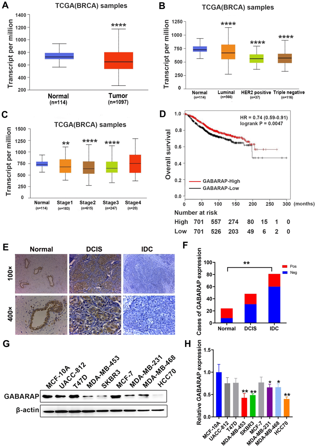 GABARAP is downregulated in breast cancer specimens and cell lines. (A) Expression profile of GABARAP in primary breast cancer tissues (n = 1097) and normal breast tissues (n = 114) (TCGA). (B) Expression of GABARAP in BRCA based on breast cancer subclasses (TCGA). (C) Expression of GABARAP in BRCA based on individual cancer stages (TCGA). (D) Overall survival of breast cancer patients according to GABARAP expression (TCGA). (E) Representative images of GABARAP immunohistochemical staining. (magnification, 100× and 400×). (F) Statistical significance of ‘positive’ or ‘negative’ GABARAP staining in 87 cases of IDC, 48 cases of DCIS and 24 cases of normal breast tissue. (G) Western blotting analysis of GABARAP expression in 8 human breast cancer cell lines and non-transformed MCF-10A cells. (H) Statistical significance of GABARAP expression in 8 human breast cancer cell lines and non-transformed MCF-10A cells. (*P P P P 