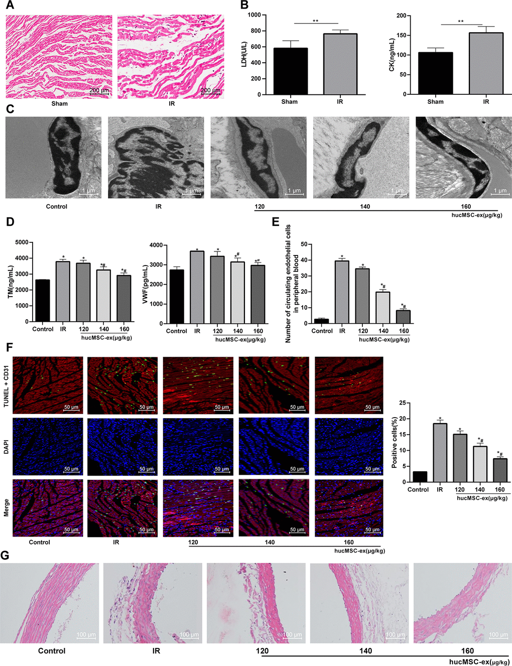 The hUCMSC-ex protects rats against the I/R injury. (A) HE staining for the detection of myocardial pathological morphology in rats injected with different concentrations of hUCMSC-ex (n = 3). (B) Levels of cardiac function indexes LDH and CK in I/R rats injected with different concentrations of hUCMSC-ex measured by ELISA kits (n = 8). (C) Ultrastructure of CMECs in I/R rats injected with different concentrations of hUCMSC-ex observed under transmission electron microscope (n = 3). (D) Serum TM and vWF levels in I/R rats injected with different concentrations of hUCMSC-ex measured by ELISA kits (n = 8). (E) The number of CECs in I/R rats injected with different concentrations of hUCMSC-ex measured by flow cytometry (n = 8). (F) CD31 + TUNEL-positive CMECs in I/R rats injected with different concentrations of hUCMSC-ex (n = 3). CMECs were red labeled by CD31, TUNEL-positive cells were green, and DAPI was blue. (G) HE staining of arterial intima structure in I/R rats injected with different concentrations of hUCMSC-ex (n = 3). *p vs. the control group; #p vs. the H/R group. All experiments were repeated 3 times. Data in panel (B) were analyzed with independent t test, and data in panels (E, F and G) were analyzed by one-way ANOVA and the pairwise comparisons after ANOVA were performed with Tukey’s multiple comparisons test.