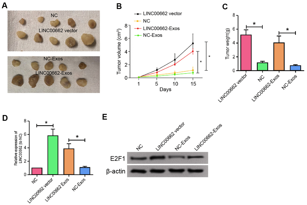 Exosomal LINC00662 contributes to the tumor growth of NSCLC in vivo. (A–D) The effect of exosomal LINC00662 on tumor growth of NSCLC cells in vivo was analyzed by nude mice tumorigenicity assay. The A549 cells were treated with LINC00662 overexpression vector or LINC00662 overexpression exosome. (A) Representative images of dissected tumors from nude mice were presented. (B) The average tumor volume was calculated and shown. (C) The average tumor weight was calculated and shown. (D, E) The protein expression levels of E2F1 and β-actin were examined by Western blot analysis in the tumor tissues. Data are presented as mean ± SD. Statistic significant differences were indicated: * P P 