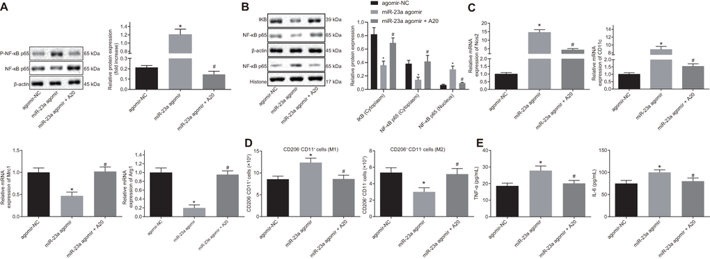 Overexpression of miR-23a enhances inflammation response and M1 polarization of macrophages by inhibiting A20 and activating NF-κB. Macrophages were treated with exogenous miR-23a agomir (agomir-NC used as control) or exogenous miR-23a agomir and A20. (A) protein levels of p-NF-κB p65/NF-κB p65 in macrophages measured using Western blot analysis, normalized to β-actin; (B) protein levels of NF-κB p65 in the nucleus and cytoplasm measured using Western blot analysis, normalized to β-actin; (C) mRNA expression of Nos2, CD11c, Mrc1, and Arg1 determined using RT-qPCR in macrophages, normalized to β-actin; (D) M1 polarization of macrophages detected by flow cytometry; (E) levels of TNF-α and IL-6 measured by ELISA in macrophages. Values obtained from three independent experiments are expressed as mean ± SD and analyzed by one-way ANOVA followed by Bonferroni’s multiple comparison test among multiple groups. * p vs. macrophages treated with antagomir-NC plasmids; # p vs. macrophages treated with miR-23a agomir plasmids. Cell experiment was independently repeated for three times.