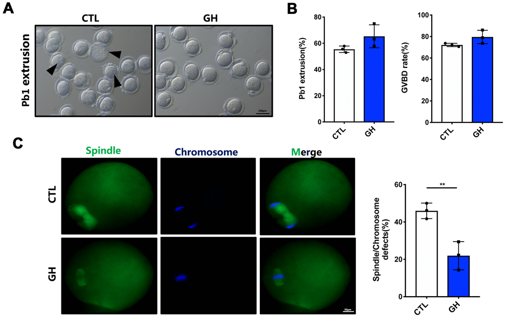 Effects of GH treatment in vitro on the meiotic progress of aged oocytes. (A) Representative images of oocytes after 14 hours cultured in M2 medium (n = 87) and GH treated medium (n = 88). Black arrowheads point to oocytes that fail to extrude a polar body or fail to survive. Scale bar, 100 μm. (B) The rate of GVBD and Pb1 extrusion in these two groups respectively. (C) Left: Spindle morphologies in control and GH group. Oocytes were stained with α-tubulin (green) and hoechst (blue). Scale bar, 50 μm. Right: Percentages of oocytes with spindle defects in control (n = 51) and GH group (n = 68). Data are presented as mean ± SD. **P 