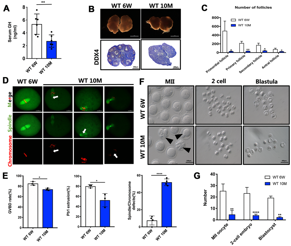 Growth hormone ameliorates the age-associated depletion of ovarian