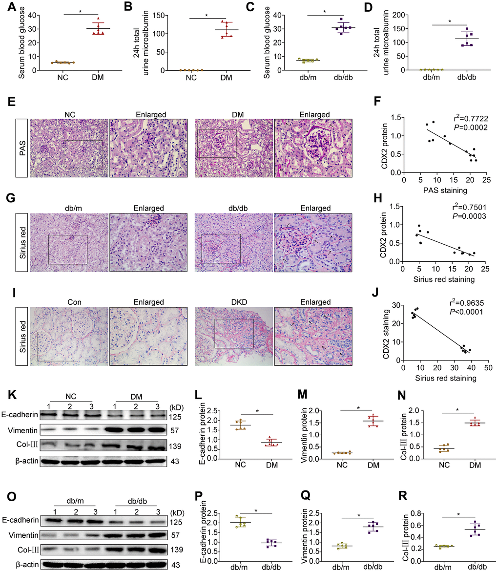 CDX2 is negatively related to the development of DKD. (A, B) Blood glucose (A) and 24h total urine microalbumin (B) were significantly increased in T1D mice than controls. (C, D) Blood glucose (C) and 24h total urine microalbumin (D) were significantly increased in T2D mice than controls. Positive staining density of PAS and Sirius Red was analyzed in each group from 6 random fields (200×). (E, F) PAS staining (E), correlation of CDX2 staining with PAS staining in the kidneys of T1D mice and controls (F, r = 0.7722; P = 0.0002). (G, H) Sirius Red staining (G), correlation of CDX2 staining with Sirius Red staining in kidneys of T2D mice and controls (H, r = 0.7501; P = 0.0003). (I, J) Sirius Red staining (I), correlation of CDX2 staining and Sirius Red staining in the kidneys of DKD patients and controls (J, r = 0.9635; P = 0.0001). (K–N) Immunoblot bands of E-cadherin, Vimentin, and Col-III in T1D mice and controls (K), quantitative data are presented (L–N). (O–R) Immunoblot bands of E-cadherin, Vimentin, and Col-III in T2D mice and controls (O); quantitative data are presented (P–R). Data are mean±SD from three independent assays. n=6; *P