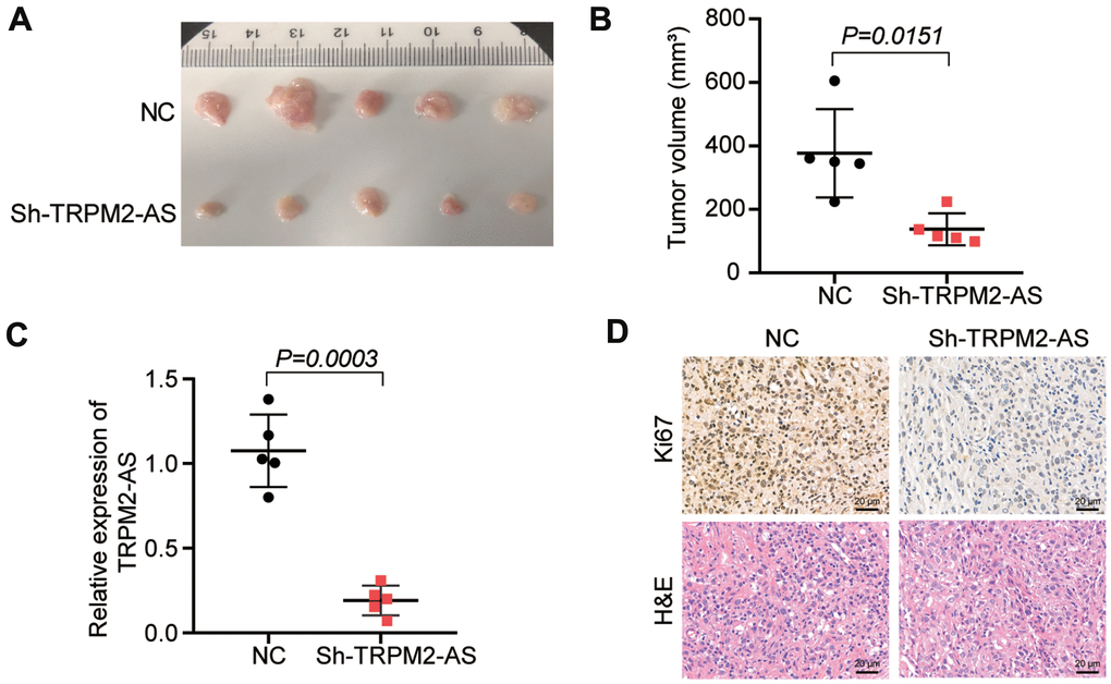 TRPM2-AS knockdown inhibited the OvC progression in vivo. (A) The subcutaneous tumors derived from the mice with the negative control transfected SKOV3 cells or sh-TRPM2-AS transfected SKOV3 cells for 30 days. (B) The tumor volumes were measured 30 days after the negative control or sh-TRPM2-AS transfected SKOV3 cells were subcutaneously injected into the nude mice. (C) The TRPM2-AS expression in the tumor tissues. (D) Ki67 staining and H&E pathological staining assay proved the inhibitory effect of TRPM2-AS knockdown on cell proliferation in vivo. Scale bar, 20 μm. Sh-TRPM2-AS, TRPM2-AS knockdown vectors. **P