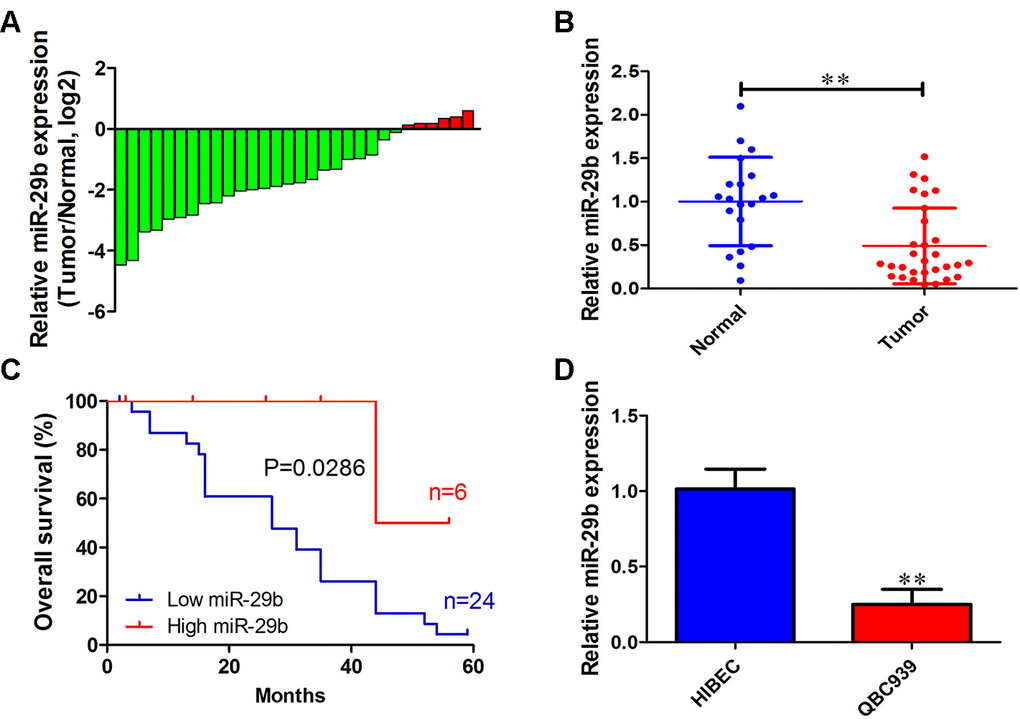 miR-29b downregulation is associated with poor overall survival in cholangiocarcinoma. (A) Relative miR-29b expression in 30 patients with cholangiocarcinoma after normalization to adjacent, normal tissue expression (B) miR-29b expression data for 30 cholangiocarcinoma and 20 non-tumor specimens. (C) Kaplan-Meier curves for cholangiocarcinoma patients with low and high expression of miR-29b. (D) Relative expression of miR-29b in the human cholangiocarcinoma cell line QBC939 and in human intrahepatic biliary epithelial cells (HIBEC). The values presented are means ± SD. *PP