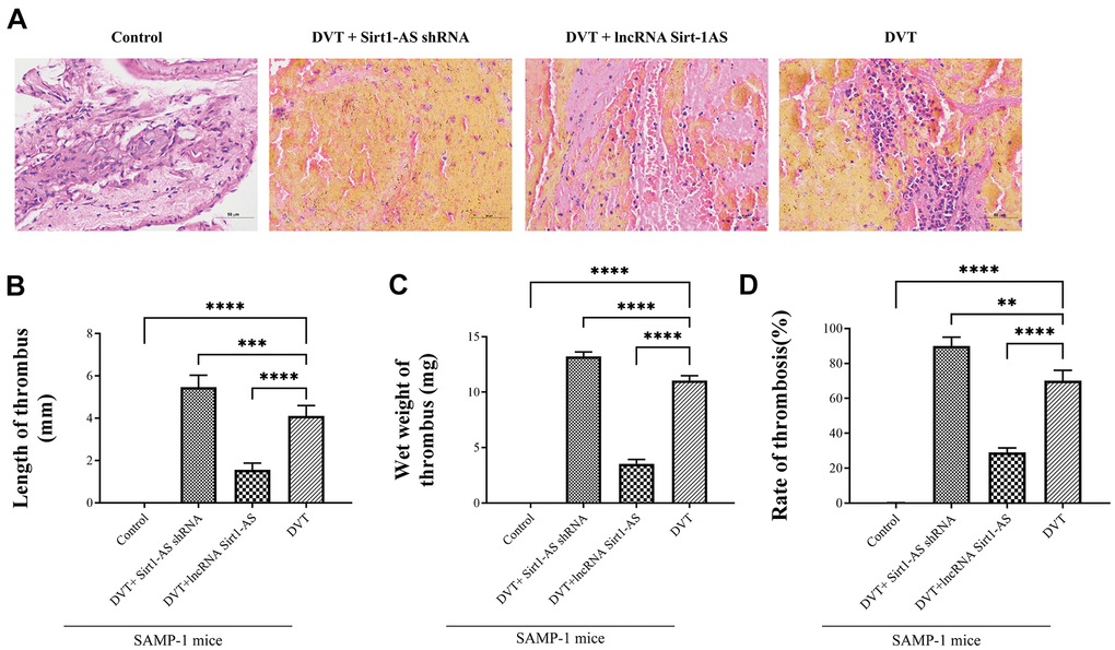 LncRNA Sirt1-AS upregulates Sirt1 and alleviates DVT. (A) HE staining of endothelia of SAMP-1 mice. (40*). (B–D) The rate of thrombus, length and wet weight of thrombus of SAMP-1 mice. Error bars represent SD. **, p 