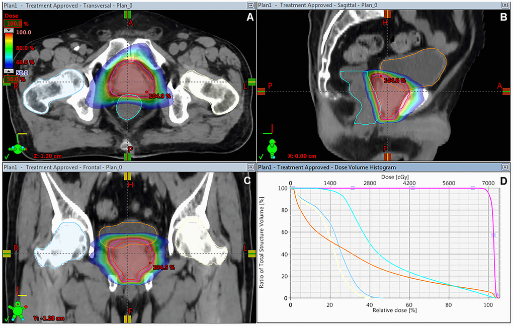 Hypofractionated Versus Conventionally Fractionated Image guided 