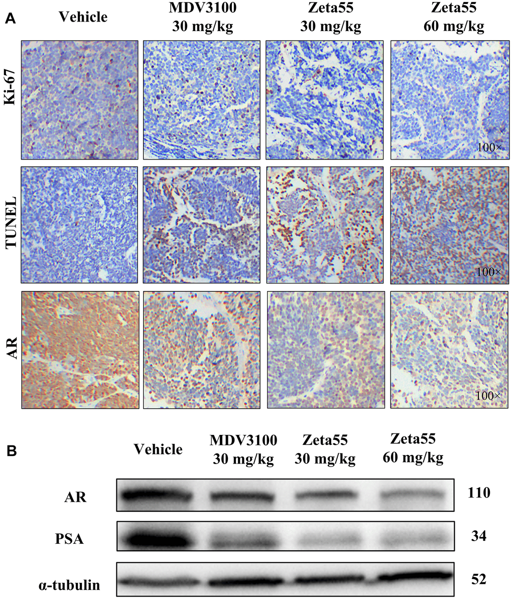 Immunohistochemistry and Western blot analysis of tumor xenografts. (A) Ki67, TUNEL and AR of different group xenografts were stained and evaluated at 100× magnifications. (B) AR and PSA of a representative xenograft in each group were analyzed by Western blot.