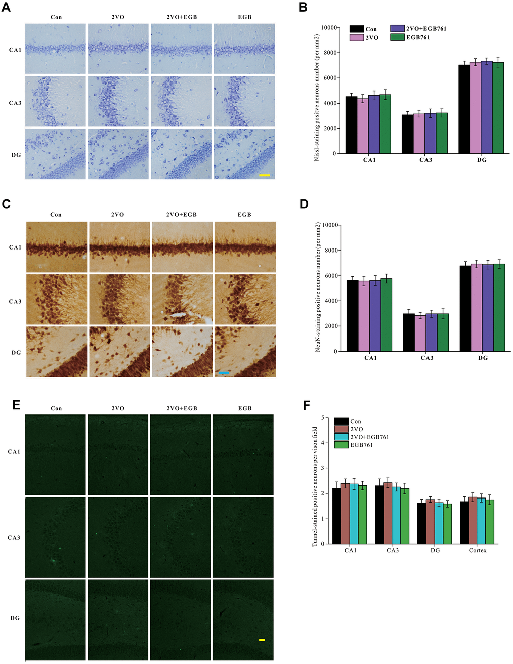 CCH did not change the neurons density and apoptosis in hippocampus. The brain sections were stained by Nissl staining solutions, NeuN antibody and TUNNEL staining kit. Nissl staining slides were showed (A) (Bar scale= 25μm) and neurons in subregions of hippocampus were counted (B). NeuN labeled neurons were showed (C) (Bar scale= 25μm) and neurons in subregions of hippocampus were counted (D). TUNNEL staining section was showed (E) (Bar scale= 100μm) and counted (F) (n=3 for 4 group).