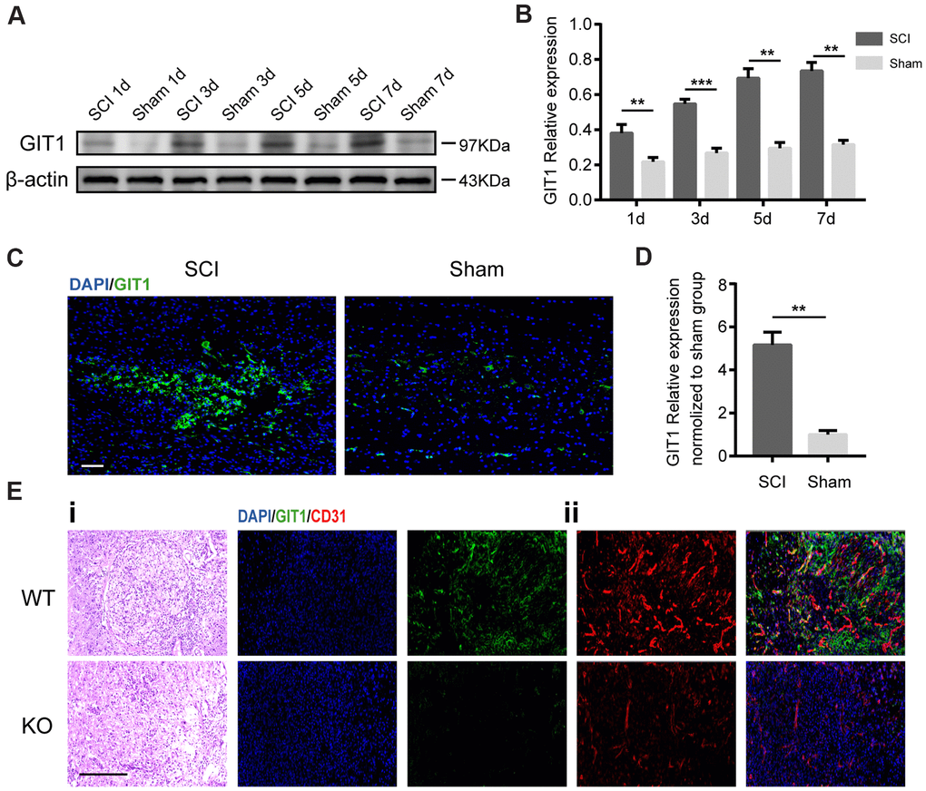 GIT1 is highly expressed in vivo after SCI. (A, B) Western blots and semiquantification of GIT1 at each time point after SCI or sham surgery. (C, D) Immunofluorescence images for GIT1 (green) and quantification at day 7 after SCI or sham surgery. Nuclei were counterstained using DAPI (blue). Scale bar, 100 μm. (E) Spinal cord at 7 days post-SCI: (i) representative H&E images in the lesion site from the GIT1 WT and KO groups. Bar, 100 μm. (ii) IF staining of GIT1 (green) and CD31 (red) in the lesion epicenter from the GIT1 WT and KO groups. Nuclei were stained using DAPI (blue). Scale bar, 100 μm. N = 5 animals per group. ***p ***p 