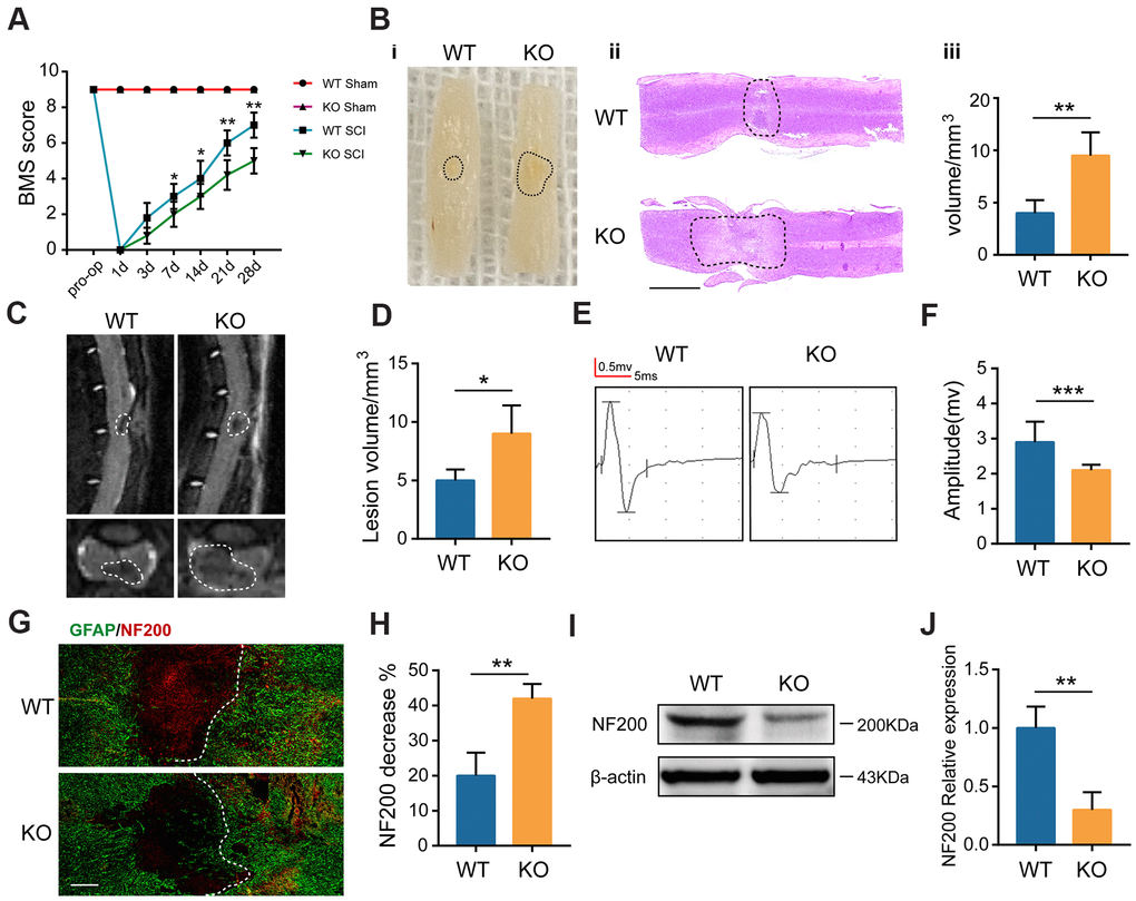 GIT1 deficiency exacerbates SCI-induced spinal cord damage. (A) Basso Mouse Scale results over 28 days. (B) Spinal cord at 28 days post-SCI: (i) gross morphology, (ii) representative H&E stained sections. Scale bar = 2000 μm, and (iii) the lesion volumes. (C, D) Sagittal and axial spinal cord T2 weighted images at day 28 after SCI. (E, F) MEP analysis. (G, H) IF staining of GFAP (green) and NF200 (red) at the injury sites at 7 days after SCI. Nuclei were stained using DAPI (blue); the dashed lines represent the boundary of the injury area. Scale bar = 100 μm. (I, J) Representative western blots of NF200 and the semiquantification of relative expression levels of NF200. N = 6 animals in each group. *p **p ***p 