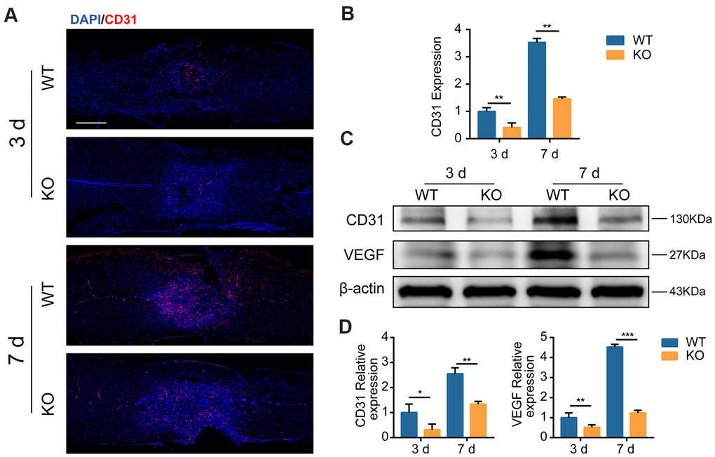 GIT1 promotes MECs angiogenesis in vivo. (A, B) Representative IF and quantification of microvessels and MECs at the injury core in the GIT1 WT and KO groups at day 3 and 7 after SCI. Nuclei were counterstained with DAPI (blue). Bar = 500 μm. (C, D) Representative western blots of CD31 and VEGF and the semiquantification of relative expression levels of CD31 and VEGF. N = 5 animals in each group. *p **p ***p 