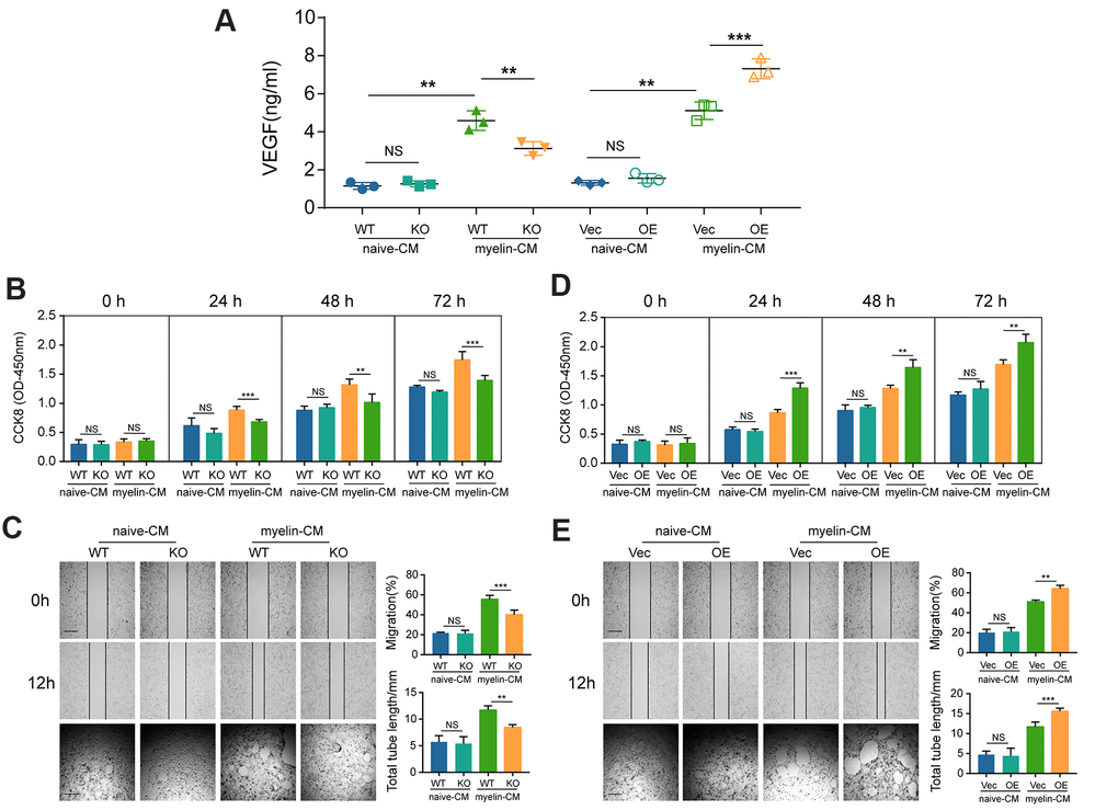 GIT1 deficiency inhibits BMECs proliferation and angiogenesis in vitro. (A) ELISA detection of VEGF in the CM of BMECs from the different groups after being treated with or without myelin debris for 72 h. (B, D) Proliferation of BMECs cultured with CM from the different groups examined by CCK8 at 0, 1, 2, and 3 d. (C, E) Migration and tube formation of BMECs treated with CM from the different groups. The images of scratch wound and tube formation assays (left) and quantification of the migration ability and cumulative tube length (right). Scar bar, 100 μm. N = 6 in each group. NS represents no significance, *p **p ***p 