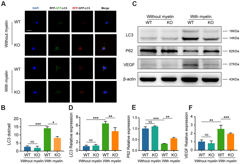 GTI1 promotes MECs to clear myelin debris via autophagy pathway. (A) BMECs from the GIT1 WT and KO mice were transfected with the mRFP-GFP-LC3 adenovirus. The cells nuclei were stained using DAPI (blue). Bar, 10 μm. (B) Numbers of yellow and red puncta. (C–F) LC3, P62, and VEGF levels in BMECs from the GIT1 WT and KO mice after being treated with or without myelin debris for 72 h. N = 6 in each group. NS indicates no significance, *p **p ***p 