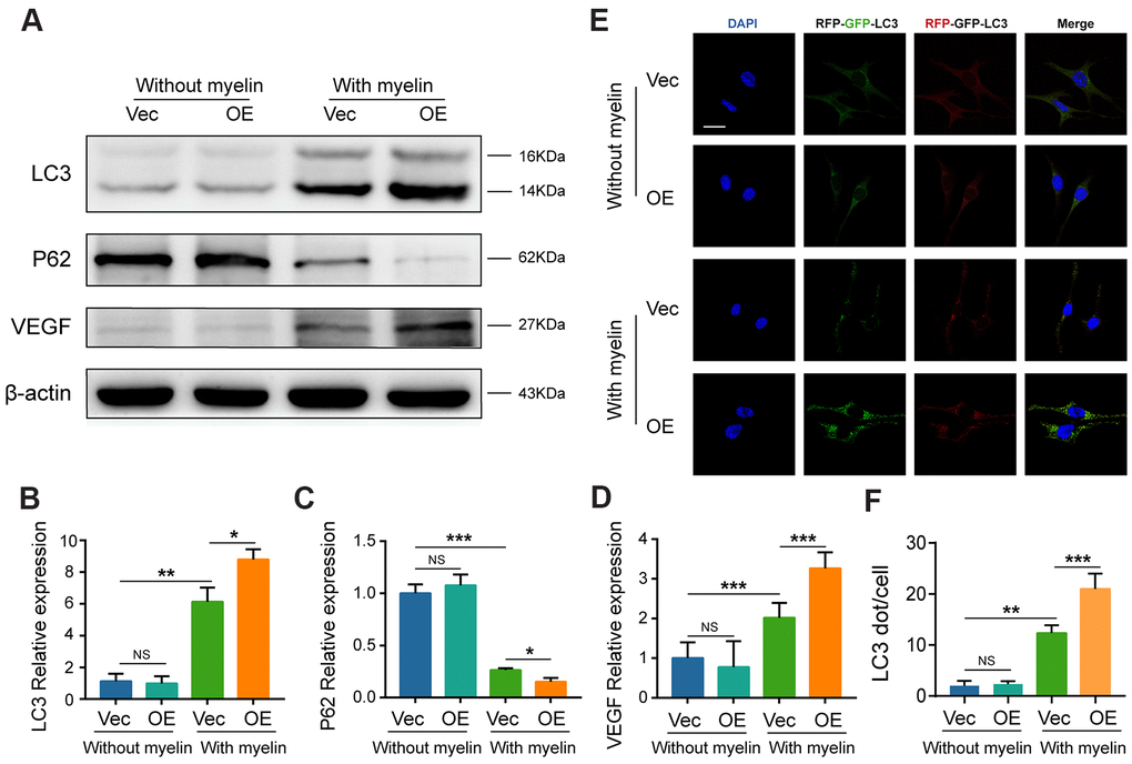 Overexpression of GIT1 increases myelin-induced autophagy in vitro. (A–D) LC3, P62, and VEGF levels in BMECs from the control and GIT1-OE groups after being treated with or without myelin debris for 72 h. (E) BMECs from the control and GIT1-OE groups were transfected with mRFP-GFP-LC3 adenovirus. The cells nuclei were stained using DAPI (blue). Bar, 10 μm. (F) Numbers of yellow and red puncta. N = 5 per group. NS represents no significance, *p **p ***p 