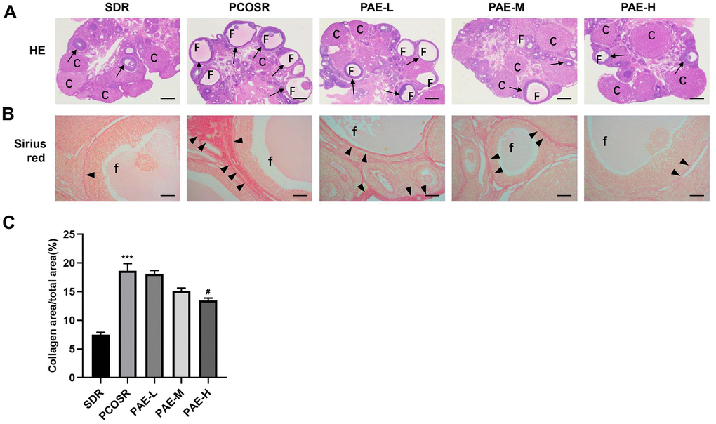 Influence of PAE on ovarian structure, follicle growth and ovarian collagen deposition in PCOS rats. Rats were executed at diestrus. (A) Representative pictures of ovarian tissues in PCOS rats (Hematoxylin and eosin staining, Scale bars = 500 μm, n=10 for each group). (B) Sirius red staining under a light microscope (Scale bars = 100 μm, n=10 for each group). (C) Proportion of the area containing collagen to the ovarian area (mean ± SEM, n=10 for each group). *P 