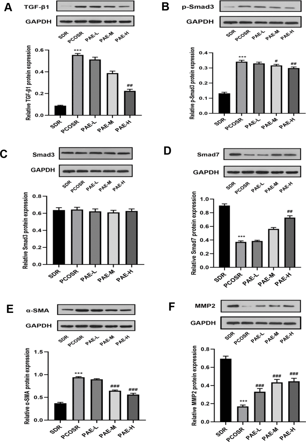 Influence of PAE on the activation of TGF-β1/Smads signaling pathway in PCOS rats was evaluated by western blot. The protein expressions of (A) TGF-β1, (B) p-Smad3, (C) Smad3, (D) Smad7, (E) α-SMA and (F) MMP2 were detected in ovarian tissues of PCOS rats. Same one GAPDH was used as the internal standard in (A, D, E). Same one GAPDH was used as the internal standard in (B, C, F). *P 