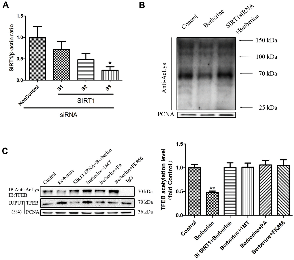 Berberine deacetylates TFEB by activating SIRT1. (A) The mRNA level of SIRT1 following siRNA treatment. Data was analyzed by one-way ANOVA with Tukey HSD post-hoc test (vs. Control group). (B) Acetylation levels in primary peritoneal macrophages after different treatments. Data was analyzed by one-way ANOVA with Tukey HSD post-hoc test (vs. Control group). (C) Acetylation level of TFEB in the nucleus of primary peritoneal macrophages after different treatments. All values are expressed as mean ± SD (error bars) of three independent experiments. n = 3; *p **p 