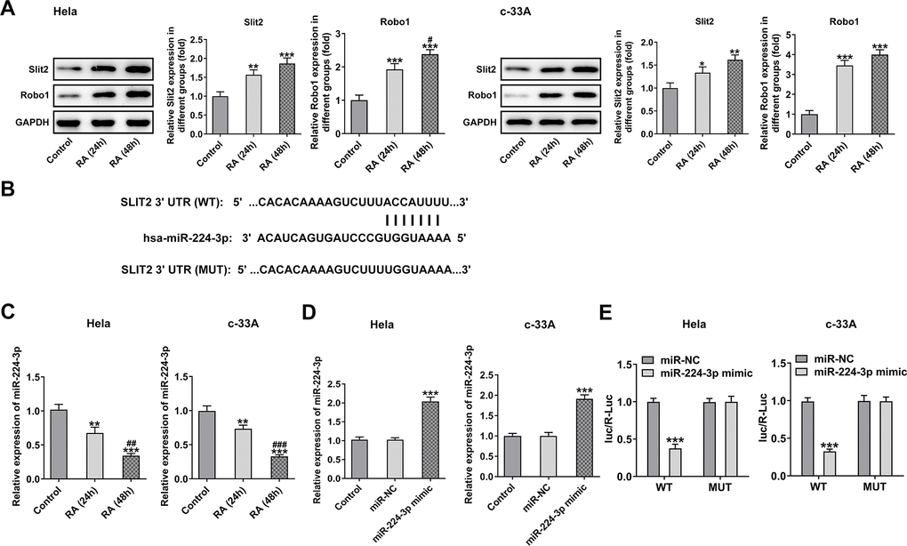 RA activates the Slit2-Robo1 signaling pathway. (A) The expression of Slit2 and Robo1 was detected by western blot analysis in Hela and c-33A cells treated with RA. *P*P*P#PB) The binding sites between miR-224 and Slit2 by bioinformatics analysis. (C) The expression of miR-224-3p after RA treatment was detected by RT-qPCR in these two cell lines. *P*P#P#PD) The expression of miR-224-3p was tested using RT-qPCR after transfection with miR-224-3p mimic in Hela and c-33A cells. *PE) The luciferase reporter assays were used to verify the binding sites between miR-224-3p and Slit2. *P