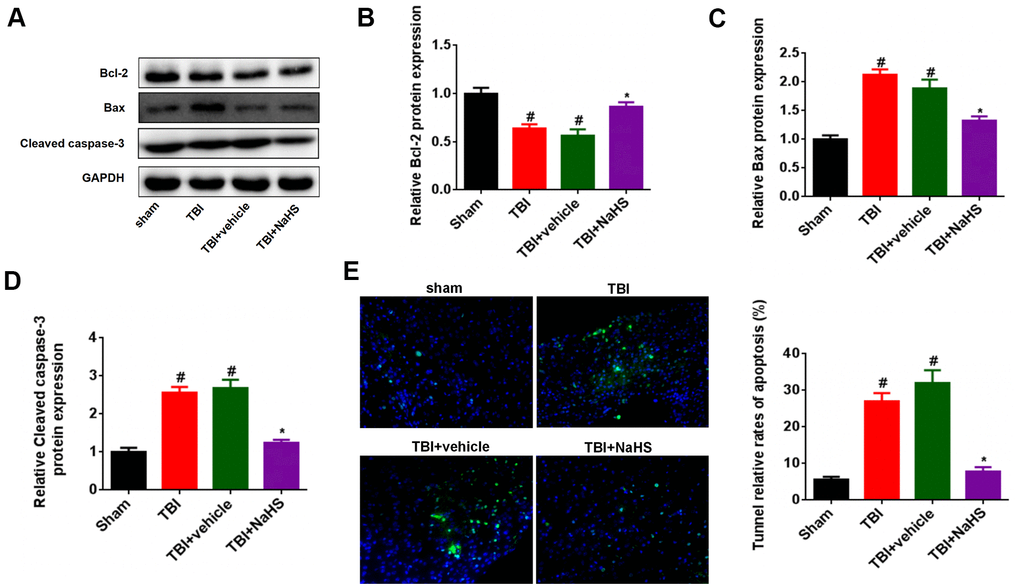 Treatment with H2S inhibited TBI-induced apoptosis. (A) Western blot was performed to analyze the protein level of Bcl-2, Bax, and Cleaved caspase-3 in TBI-challenged rats after treatment with NaHS. (B–D) The band density of Bcl-2 (B), Bax (C), and Cleaved caspase-3 (D) was analyzed using Image J. (E) The apoptosis rate of cerebral cortex in TBI rats was analyzed by Tunnel staining. * P