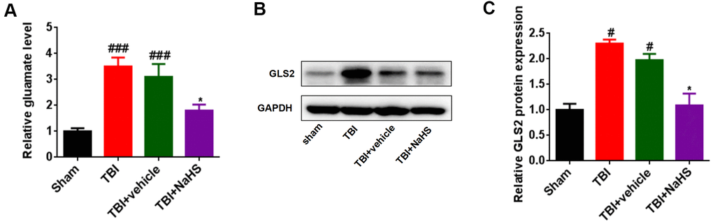 Treatment with H2S inhibited TBI-induced glutamate. (A) The level of glutamate in TBI-challenged rats after treatment with NaHS. (B) Western blot was performed to analyze the protein level of GLS-2 in TBI-challenged rats after treatment with NaHS. (C) The band density of GLS-2 was analyzed using Image J. * P