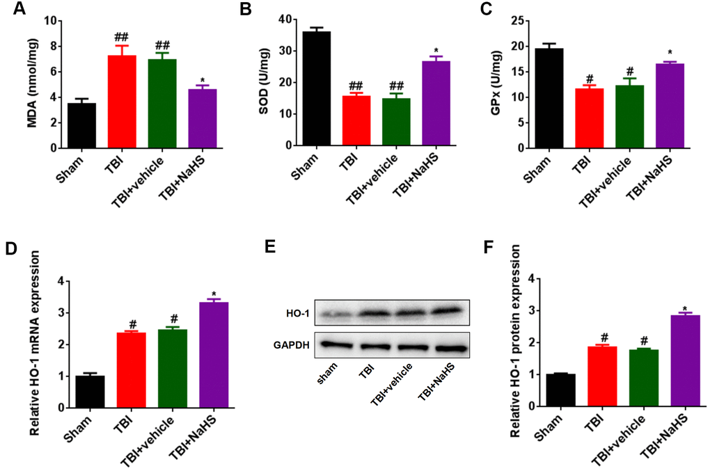 Treatment with H2S inhibited TBI-induced oxidative stress and HO-1 expression. (A) The level of MDA in TBI-challenged rats after treatment with NaHS. (B, C) The activities of SOD (B) and GPx (C) in TBI-challenged rats after treatment with NaHS. (D) The mRNA level of HO-1 in TBI-challenged rats after treatment with NaHS. (E) The protein level of HO-1 in TBI-challenged rats after treatment with NaHS. (F) The band density of HO-1 was analyzed using Image J. * P