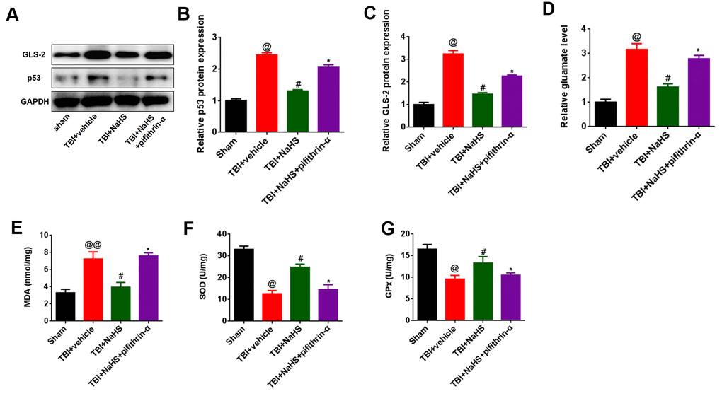 p53 inhibition reversed the effect of H2S on glutamate and glutamate-mediated oxidative stress after TBI. (A) The protein level of GLS-2 and p53 in TBI-challenged rats after co-treatment with NaHS and pifithrin-α. (B, C) The band density of GLS-2 (B) and p53 (C) was analyzed using Image J. (D) The level of glutamate in TBI-challenged rats after co-treatment with NaHS and pifithrin-α. (E) The level of MDA in TBI-challenged rats after co-treatment with NaHS and pifithrin-α. (F, G) The activities of SOD (F) and GPx (G) in TBI-challenged rats after co-treatment with NaHS and pifithrin-α. * P
