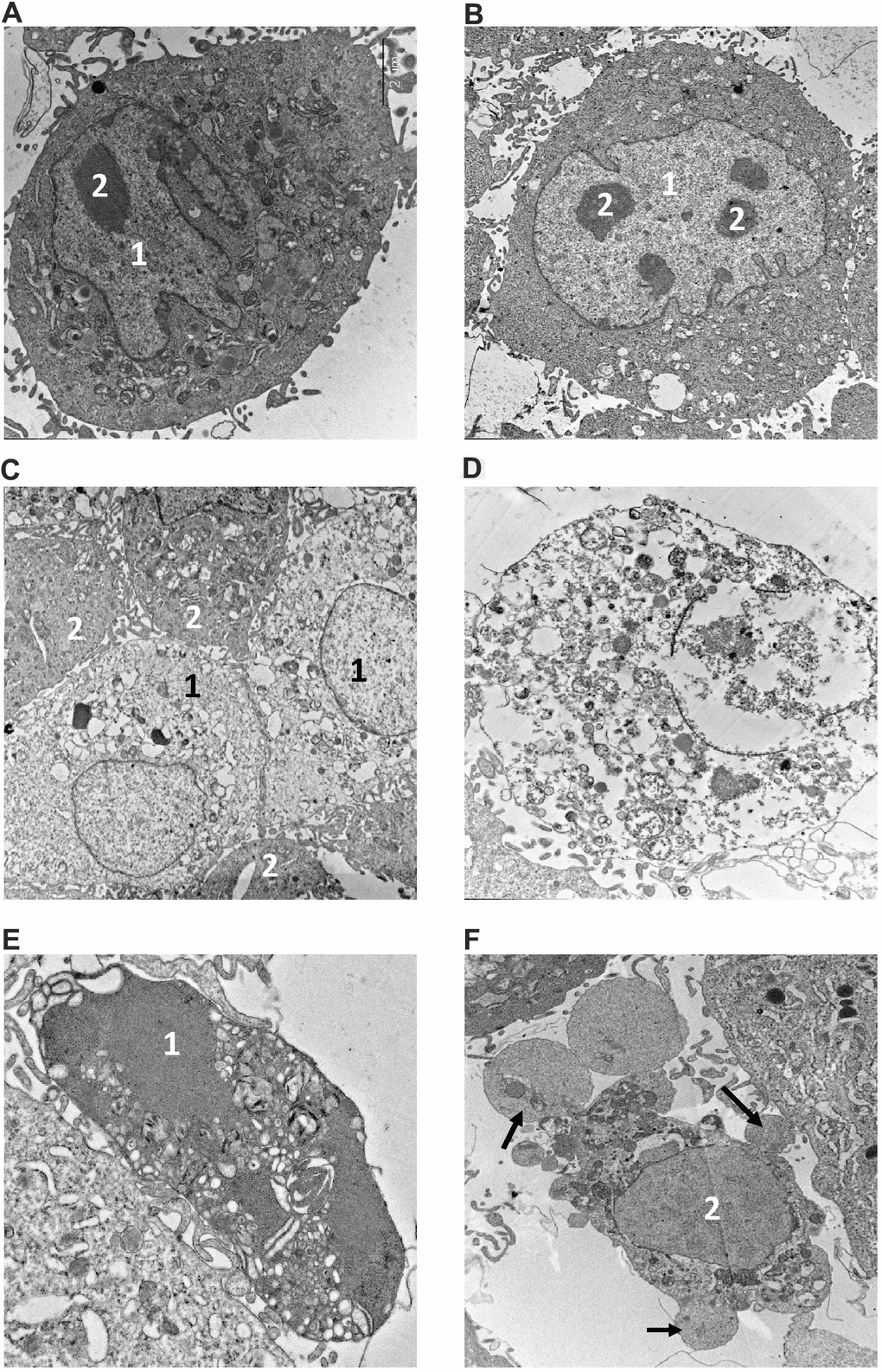 Electron microscopy analysis of MMU and NMR cells upon treatment with MMS. (A, B). The images of cells from NMR and mouse, that remained untreated, are shown. 1 – nucleus, 2 – nucleolus. (C–F). The images of cells after incubation with MMS. (C) swollen NMR cells (1) with cytoplasm of low electron density; and cells without signs of alteration (2) are shown. (D) necrotic mouse cell is shown, in which organelles are completely destroyed. Apoptosis of NMR (E) and mouse (F) cells. NMR cell nucleus (1) with condensed chromatin and organelles is shown, mouse cell demonstrates extensive “apoptotic blebbing” (“apoptotic blebs” are shown with arrows), 2 – nucleus without chromatin condensation but altered morphology.