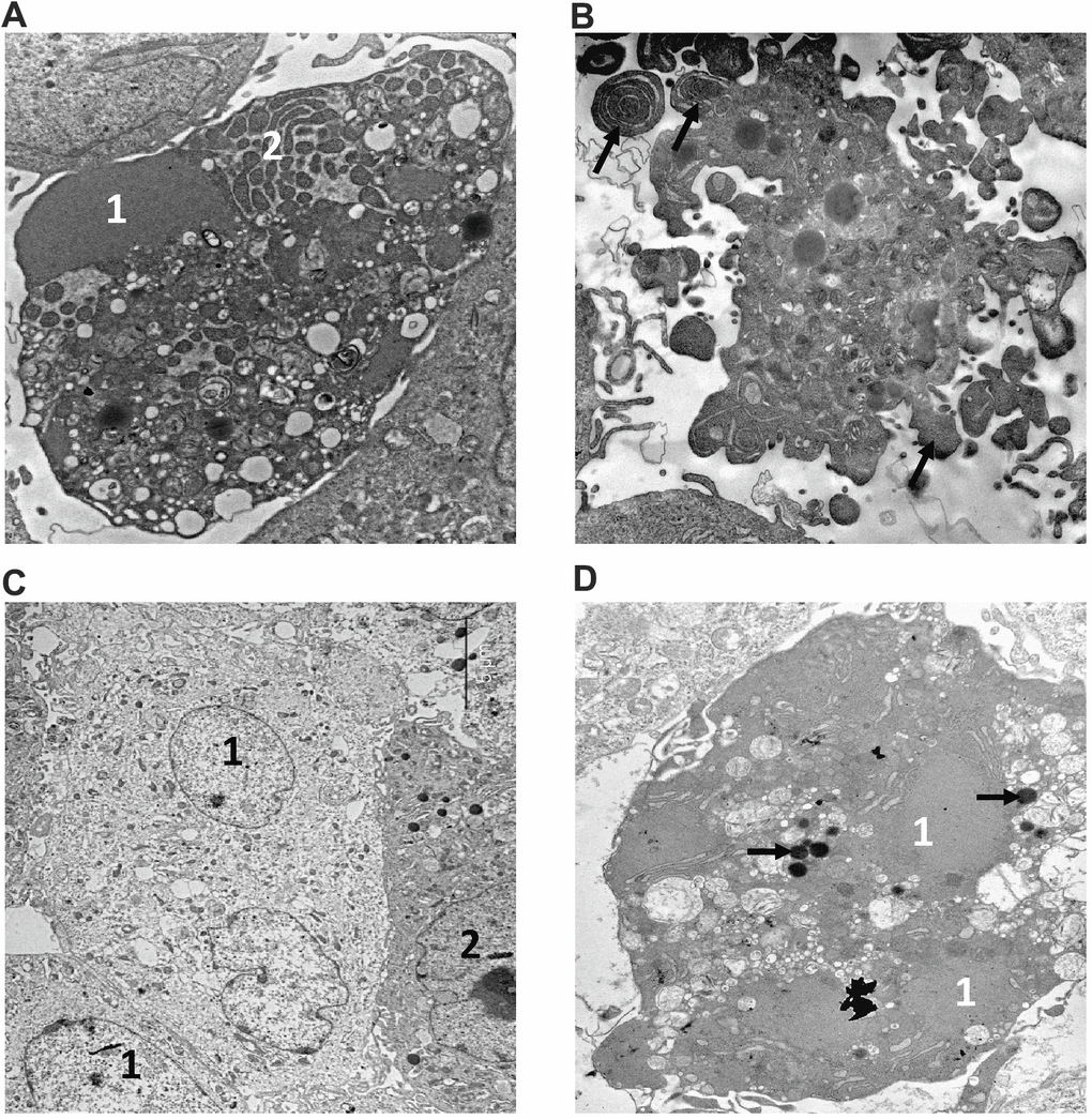 Electron microscopy analysis of MMU and NMR cells upon treatment with 5FU and Eto. Apoptotic features of cells from NMR (A) and mouse (B) incubated with 160 μM of 5FU are shown. The NMR cell is filled with the remnants of the nucleus (1) with condensed chromatin and organelles; the endoplasmic reticulum area is marked with the number "2". (B) section of mouse cell periphery demonstrates extensive apoptotic blebbing” (“apoptotic blebs” are shown with arrows). (C, D). The images of NMR cells treated with Eto are shown. (C) swollen cells (1) with cytoplasm of low electron density, and cell without signs of alteration (2). (D) apoptotic cell with a highly condensed nucleus (1) and cytoplasm. Organelles are not seen; arrows show lipid droplets.