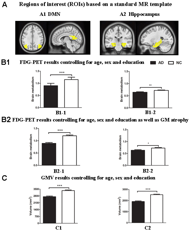 Group differences in18F-FDG SUVR and gray matter volume by using ROI analysis based on template between the AD group and the NC group. (A) ROIs of the DMN (A1) and hippocampus (A2) were defined based on template (shown in warm yellows). (B1) Metabolism results of the DMN (B1-1) and hippocampus (B1-2) controlling for age, sex and education. (B2) Metabolism results of the DMN (B2-1) and hippocampus (B2-2) controlling for age, sex and education as well as gray matter atrophy. (C) Gray matter volume results of the DMN (C1) and hippocampus (C2) controlling for age, sex and education. Bars represent average metabolism or total gray matter volume and error bars indicate standard error. *P 