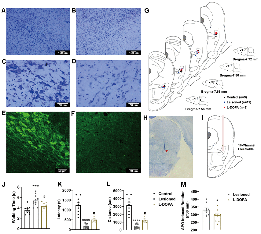 (A–D) Exemplar images of cresyl violet-stained coronal sections of the substantia nigra pars compacta of animals with 6-hydroxydopamine (6-OHDA) lesions. (A) control hemisphere, 100×; (B) lesioned hemisphere, 100×; (C) control hemisphere, 400×; (D) lesioned hemisphere, 400×. (E, F) fluorescence immunohistochemical staining of dopaminergic neurones for tyrosine hydroxylase in the substantia nigra pars compacta. (E) Control hemisphere, 200×; (F) lesioned hemisphere, 200×. (G) Schematic representation of electrode positioning in rats of different groups. (H) Image of a coronal section of PPN stained with cresyl violet. The location of the electrode tip is indicated by a red arrowhead. (I) Schematic representation of the electrode path (red line) into the pedunculopontine nucleus (PPN). (J) Walking time along a control ladder in lesioned and levodopa (L-DOPA) rats. (K) Latency in the rotarod test. (L) distance in the rotarod test. (M) Number of apomorphine (APO)-induced rotations after 30 min in lesioned and L-DOPA rats. * p 