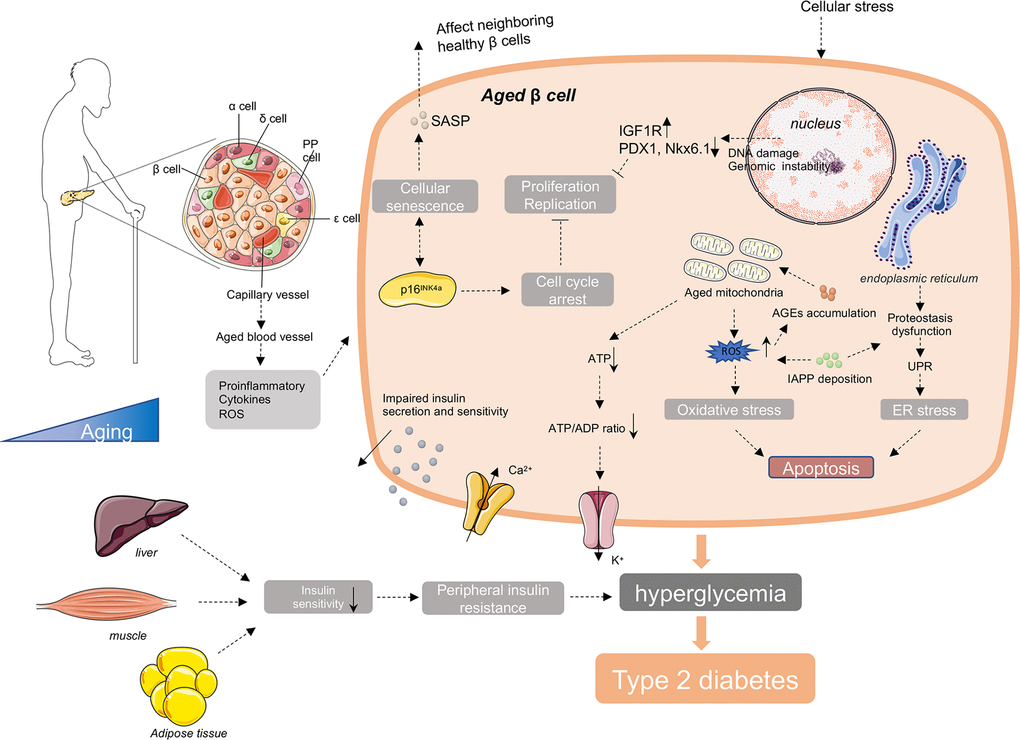 Molecular mechanisms involving in age-related diabetes. In the process of aging, there are increased accumulation of ROS, unfolded protein, DNA damage, IAPP, AGEs and other cellular stress in aged β cells. These intracellular stresses make β cells more susceptible to apoptosis. And with age, there are increased cell cycle inhibitors, such as p16INK4a, and decreased cell cycle activators, such as CDK4 and CDK6 in β cells. These changes lead to the reduce of the proliferation and regeneration potential and induce the cellular senescence of β cells. Senescent β cells secrete a series of senescence-associated secretory phenotype (SASP), promoting the senescence of neighboring healthy β cells through induction of paracrine senescence. In addition, islet blood vessels are undergoing aging as well. Oxidative damage, inflammation and fibrosis in islet blood vessels may disturb β cell function. Besides islets, the external factors include the reduction of insulin sensitivity in peripheral insulin responsive tissues with advanced age, responsible for the increased demand for insulin and final exhaustion of β cells. Taken together, the decreased insulin secretion capacity of β cells and increased insulin resistance with age lead to the failure of glucose control in elderly body, and ultimately the onset and development of age-related diabetes.